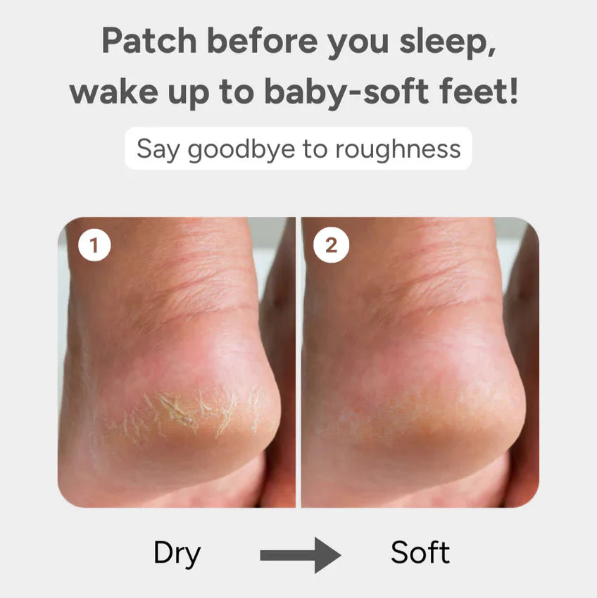 Baren Shea Butter Sleeping Heel Patch