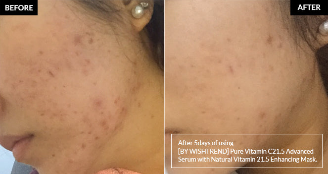 By Wishtrend Natural Vitamin 21.5 Enhancing Sheet Mask