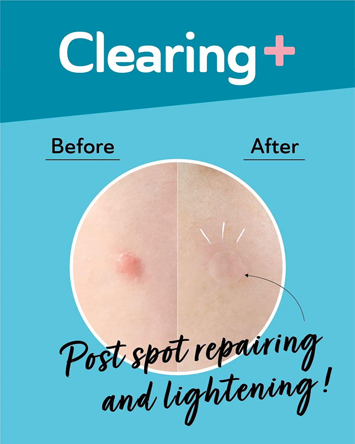 Dermaangel Ultra Invisible Dark Spot Patches Lightening