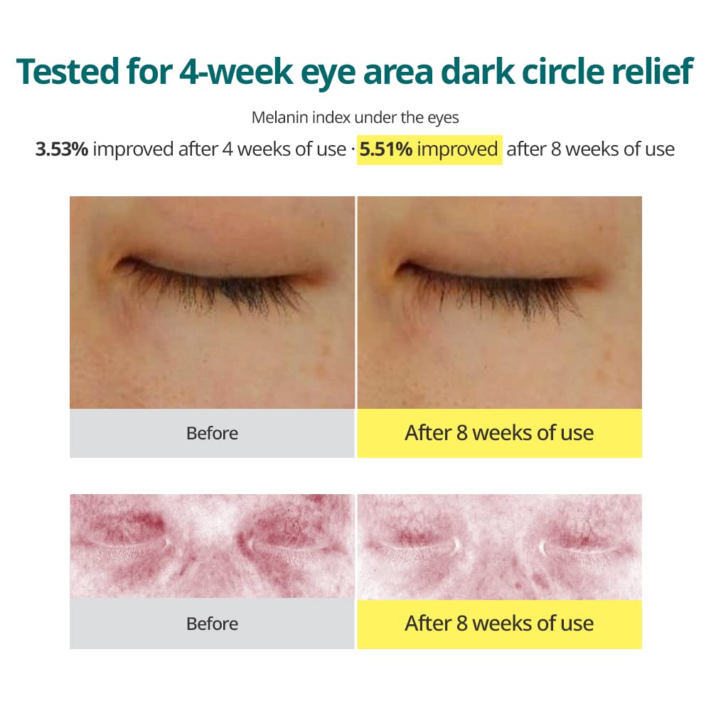 Goodal Green Tangerine Vitamin C Dark Circle Eye Cream